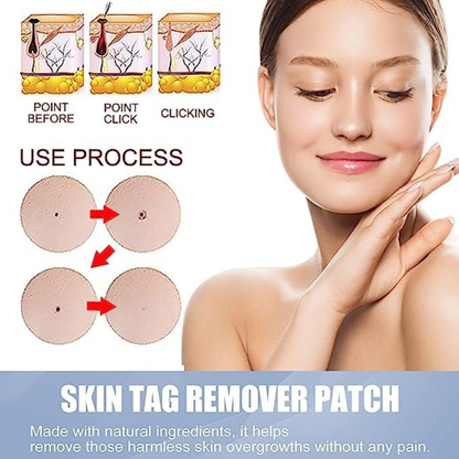 Derma Smooth Skin Tag Removal Patch - 72 Patches