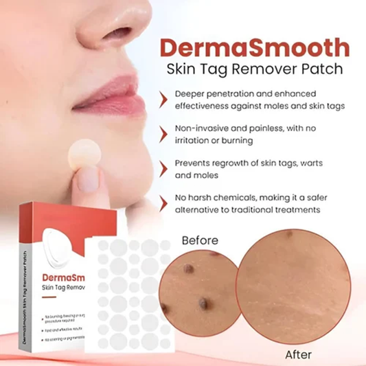 Derma Smooth Skin Tag Removal Patch - 72 Patches