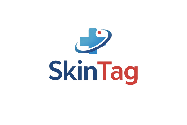 Skin Tag